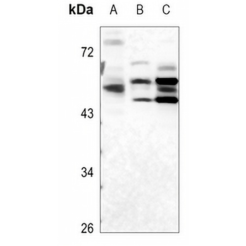 ULK3 Rabbit Polyclonal Antibody