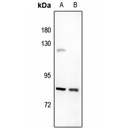 UTP14A Rabbit Polyclonal Antibody