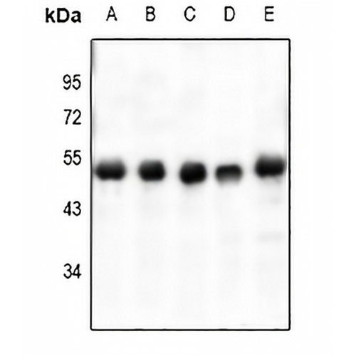 VASP (Phospho-S238) Rabbit Polyclonal Antibody