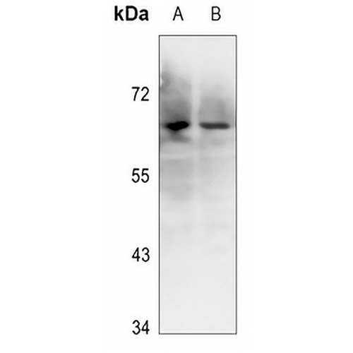Ku70 (Phospho-S5) Rabbit Polyclonal Antibody
