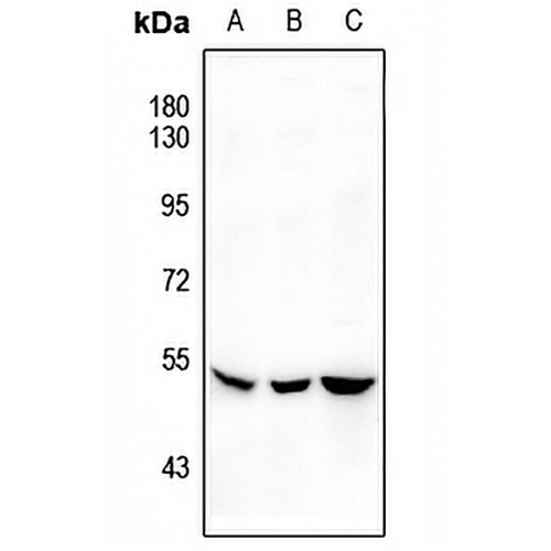 SGK1 (Phospho-S422) Rabbit Polyclonal Antibody