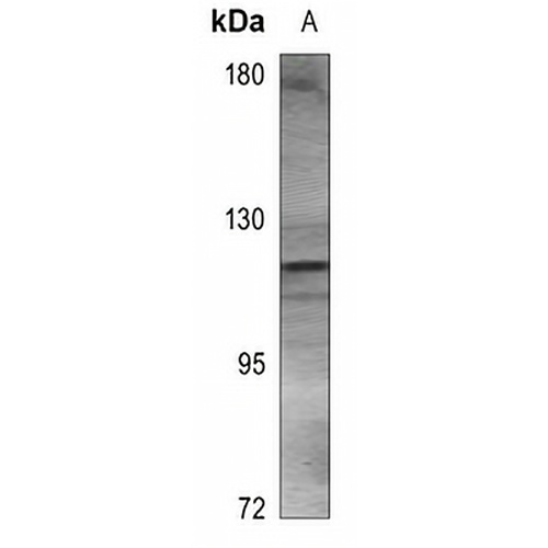 ACLY Rabbit Polyclonal Antibody