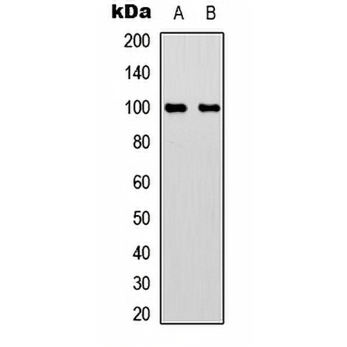 Aconitase 1 (Phospho-S711) Rabbit Polyclonal Antibody