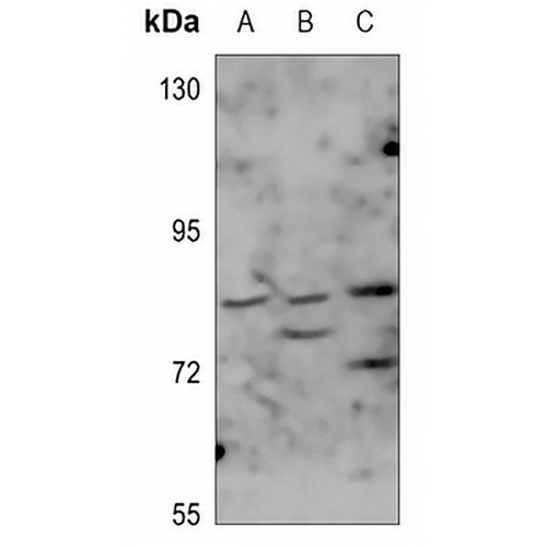 GRK2 Rabbit Polyclonal Antibody