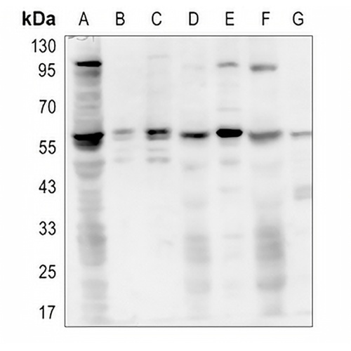 AKT (Phospho-T450) Rabbit Polyclonal Antibody