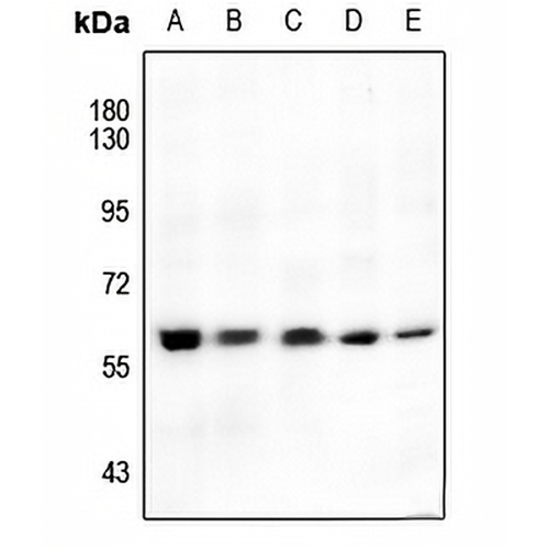 AKT (Phospho-S246) Rabbit Polyclonal Antibody