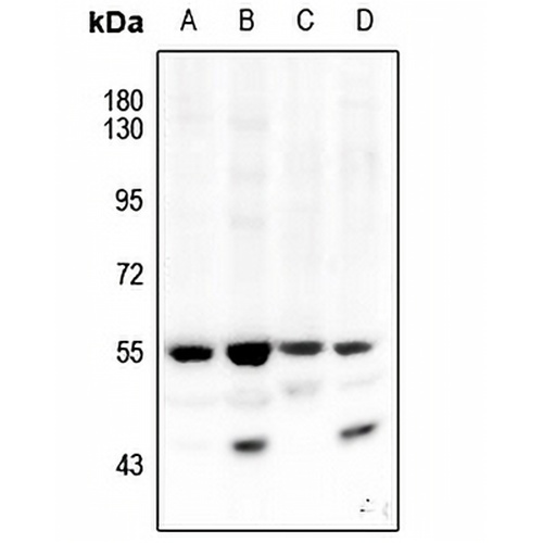 AKT1/2 (Phospho-T308/309) Rabbit Polyclonal Antibody