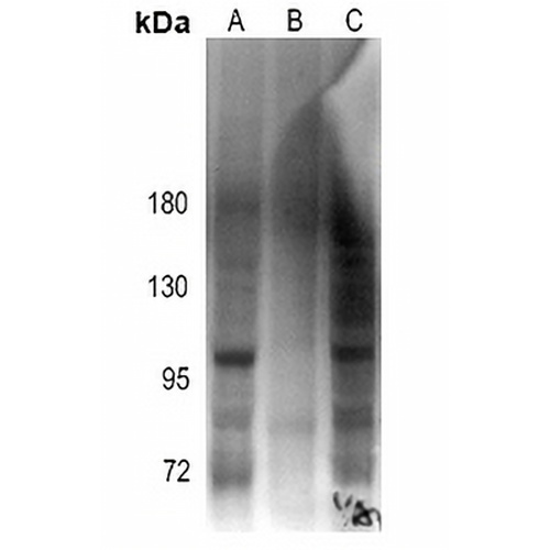 Androgen Receptor (Phospho-S213) Rabbit Polyclonal Antibody
