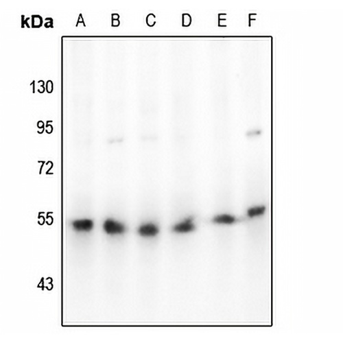 Beta-arrestin-1 Rabbit Polyclonal Antibody