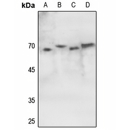 ATF2 (Phospho-S62) Rabbit Polyclonal Antibody