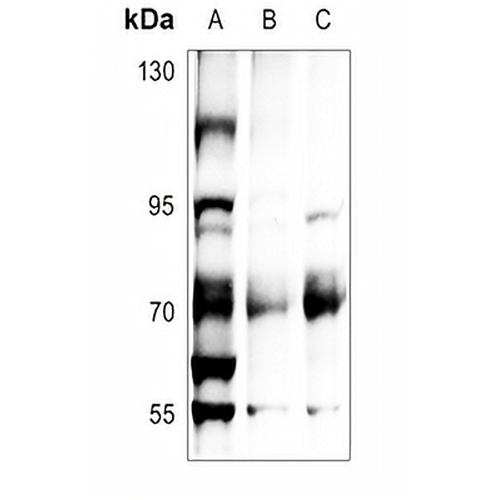 ATF2 (Phospho-T71) Rabbit Polyclonal Antibody