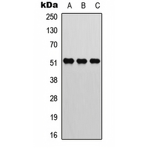 ATF2 (Phospho-T73) Rabbit Polyclonal Antibody