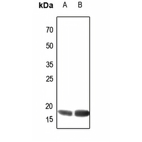 ATP5H Rabbit Polyclonal Antibody