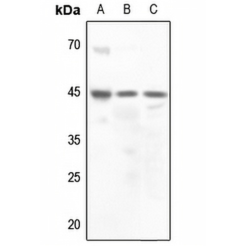 Vasopressin V2 Receptor Rabbit Polyclonal Antibody