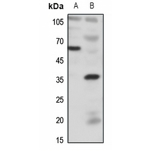 BDKRB1 Rabbit Polyclonal Antibody