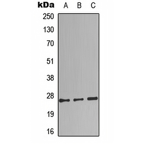 Complement C1QB Rabbit Polyclonal Antibody