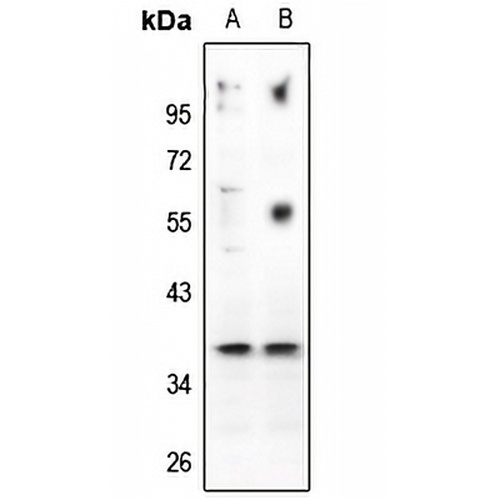 CD88 Rabbit Polyclonal Antibody