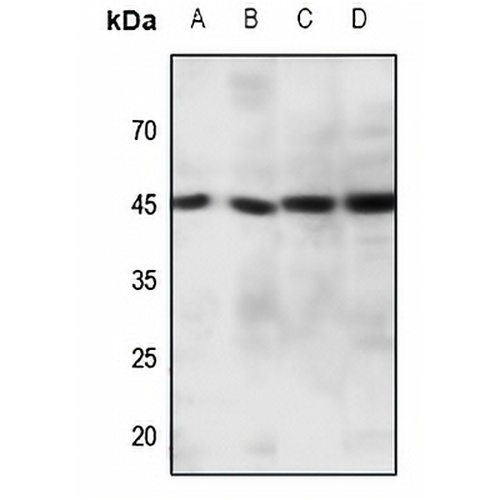 CCR11 Rabbit Polyclonal Antibody