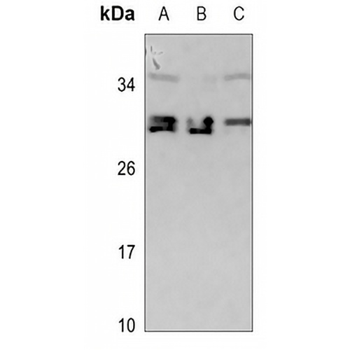 CDCA4 Rabbit Polyclonal Antibody