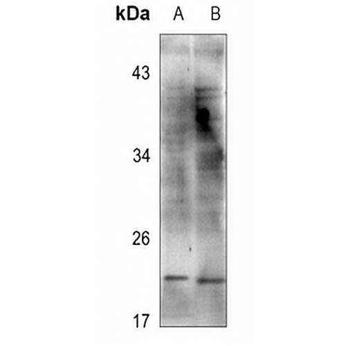Cofilin Rabbit Polyclonal Antibody