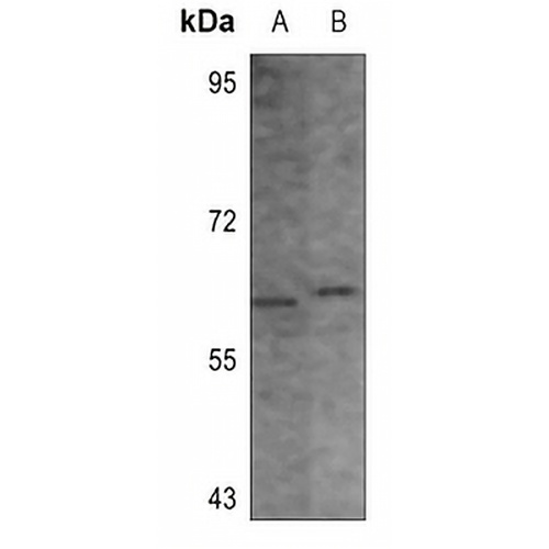 CHK1 (Phospho-S296) Rabbit Polyclonal Antibody