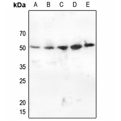 CHK1 (Phospho-S345) Rabbit Polyclonal Antibody