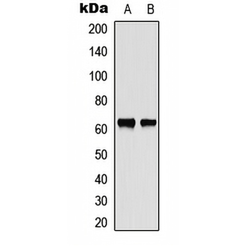 CHK2 Rabbit Polyclonal Antibody
