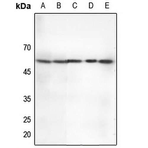 CHK2 (Phospho-T68) Rabbit Polyclonal Antibody