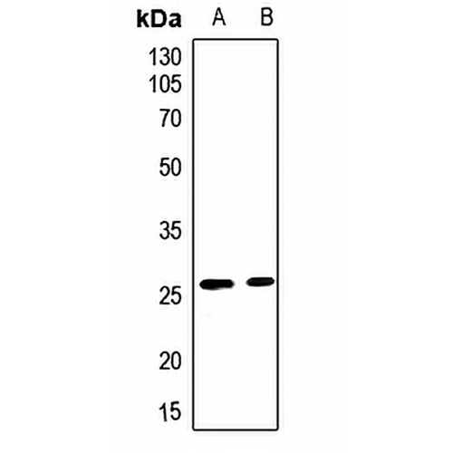 CLIC3 Rabbit Polyclonal Antibody