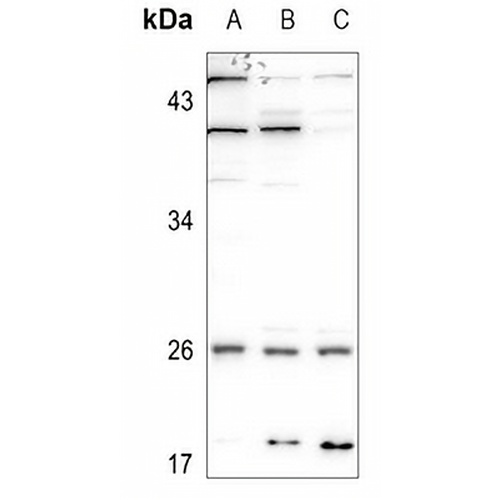 CMPK1 Rabbit Polyclonal Antibody