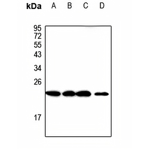 CMTM3 Rabbit Polyclonal Antibody