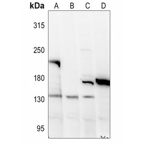 Collagen 18 alpha 1 Rabbit Polyclonal Antibody