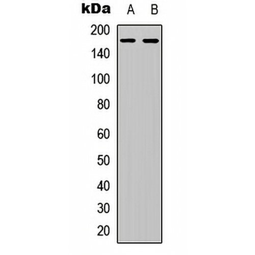 Collagen 4 alpha 6 Rabbit Polyclonal Antibody