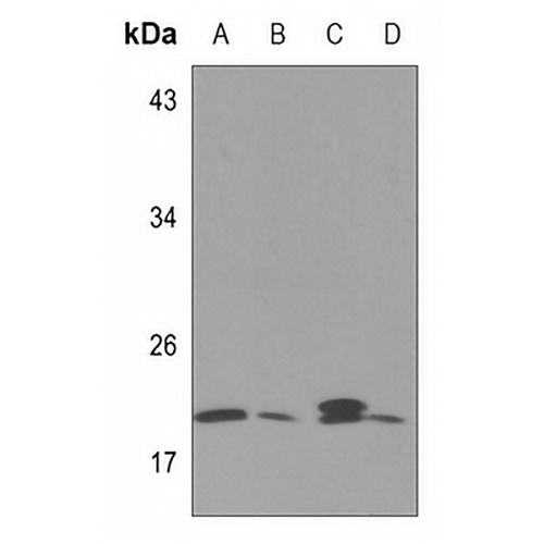Zeta COP Rabbit Polyclonal Antibody