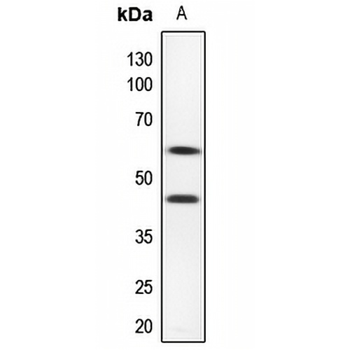 CD116 Rabbit Polyclonal Antibody