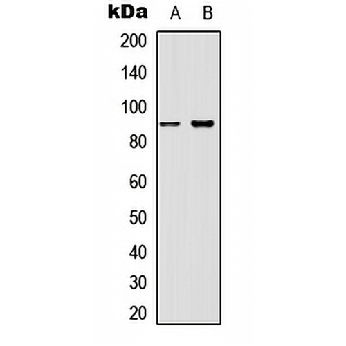 Beta-catenin (Phospho-T41/S45) Rabbit Polyclonal Antibody