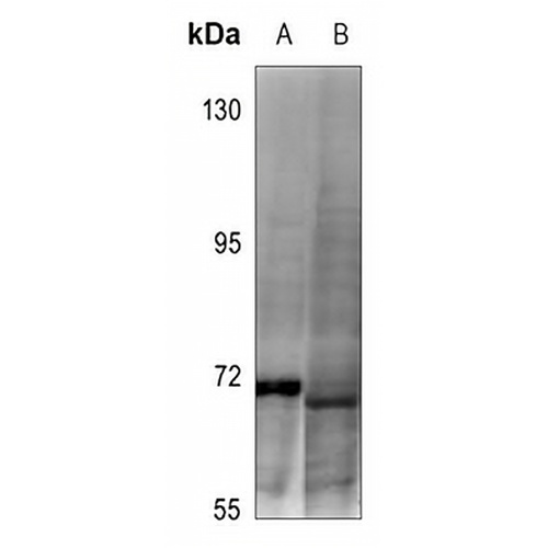 DDX5 (Phospho-Y593) Rabbit Polyclonal Antibody