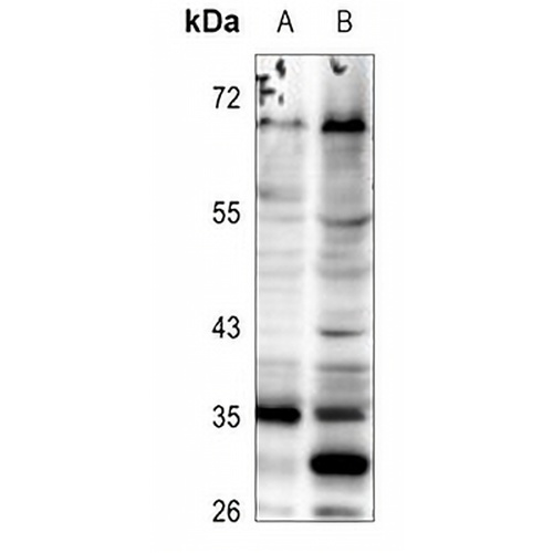 ELOVL5 Rabbit Polyclonal Antibody