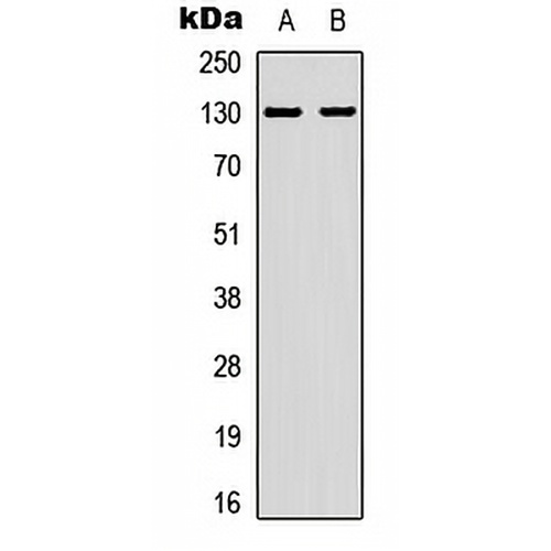 EPHA2 (Phospho-Y588/596) Rabbit Polyclonal Antibody