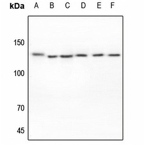 EPHA2 Rabbit Polyclonal Antibody