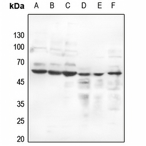 Estrogen Receptor beta (Phospho-S105) Rabbit Polyclonal Antibody