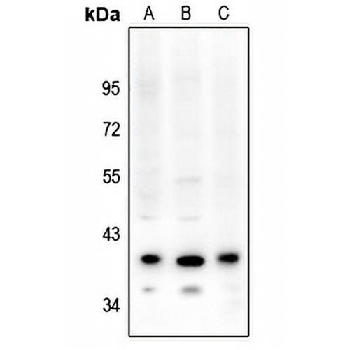PAR4 Rabbit Polyclonal Antibody