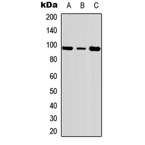 c-FER (Phospho-Y402) Rabbit Polyclonal Antibody