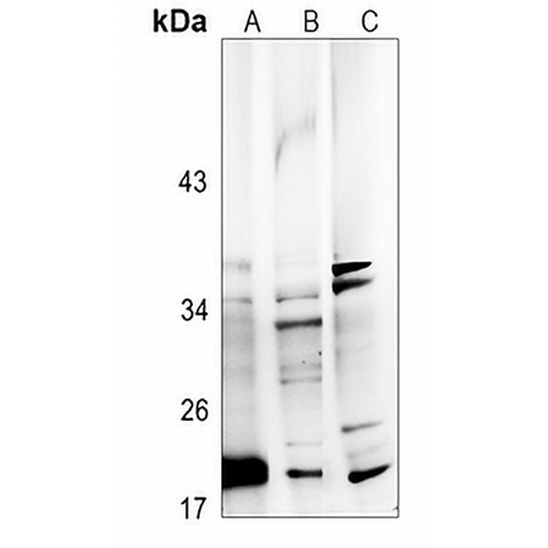 FGF22 Rabbit Polyclonal Antibody