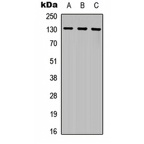 CD135 Rabbit Polyclonal Antibody