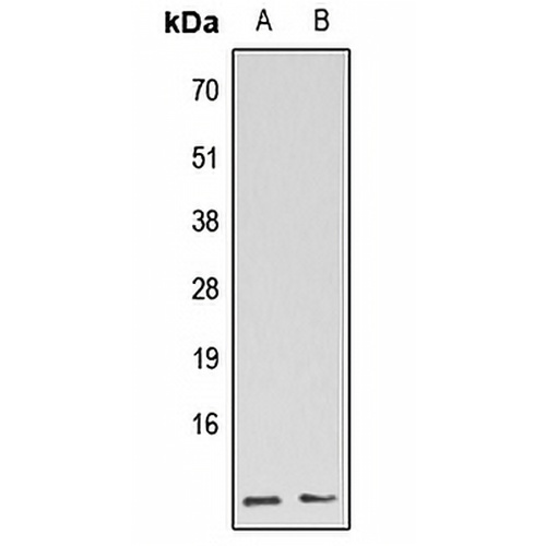GBG5L Rabbit Polyclonal Antibody