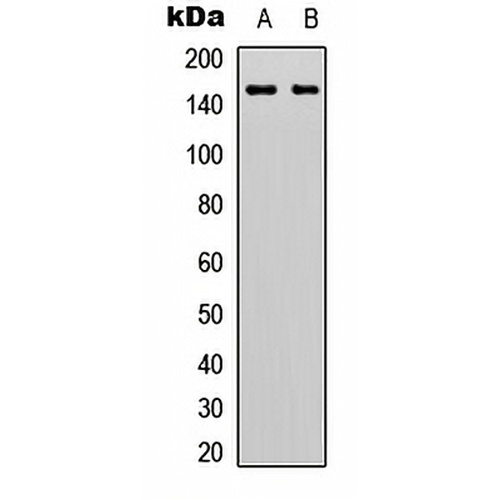 GPR116 Rabbit Polyclonal Antibody