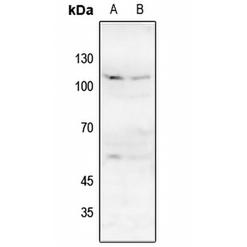 NMDAR1 (Phospho-S896) Rabbit Polyclonal Antibody