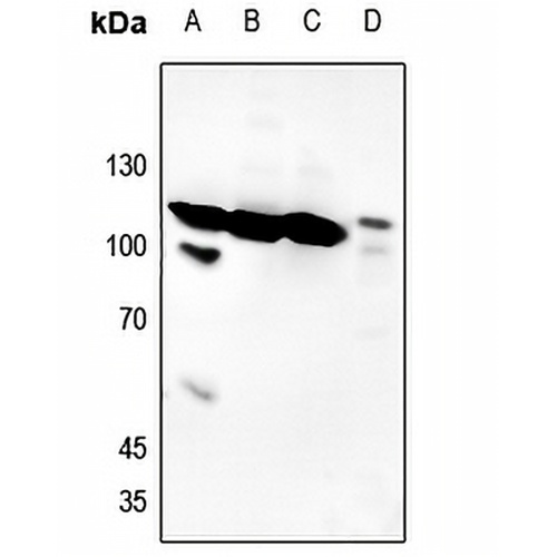 Histone Deacetylase 7 (Phospho-S155) Rabbit Polyclonal Antibody