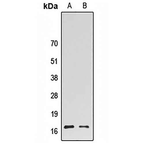HMGN2 Rabbit Polyclonal Antibody